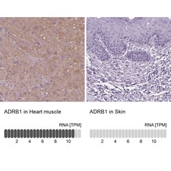 beta-1 Adrenergic R/ADRB1 Antibody, Novus Biologicals 0.1mL; Unlabeled:Antibodies,